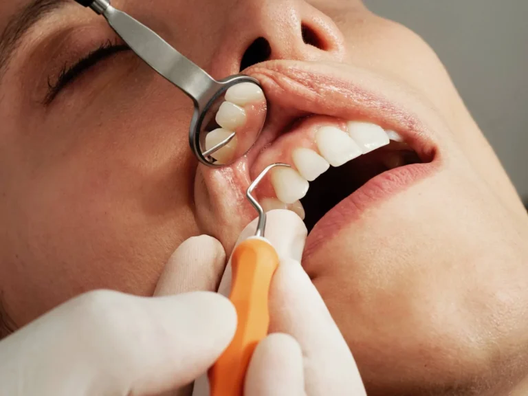 How Often Should You Get a Professional Dental Cleaning?