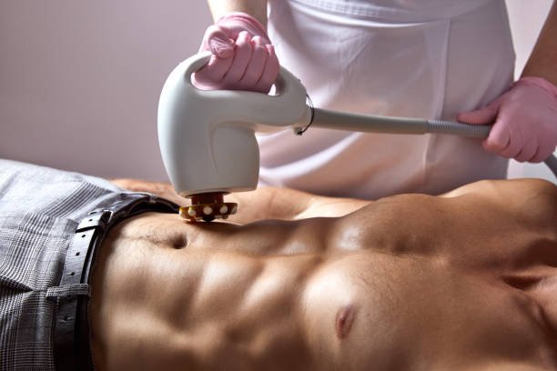 Non-Surgical Body Sculpting